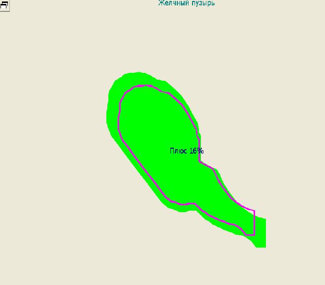 image35